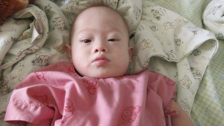 Gammy, the baby born to a Thai surrogate mother to a West Australian couple. Photo: Am Sandford