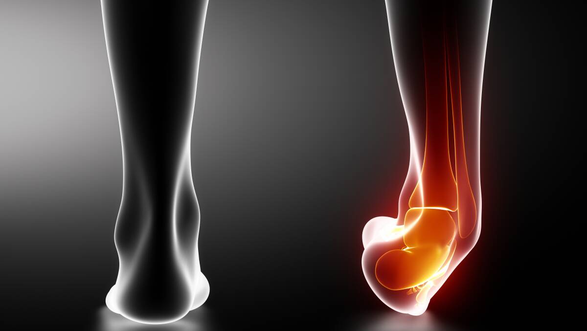 PAINFUL: Ankle injuries are often due to rolling inwards.